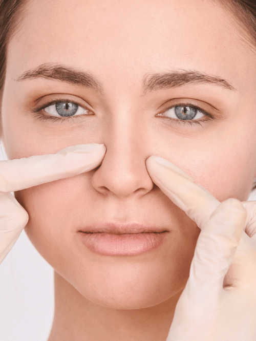 can Accutane shrink your nose?