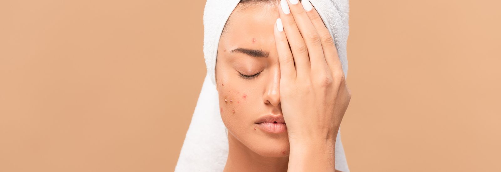 Zinc and Acne: Does It Help or Hurt?